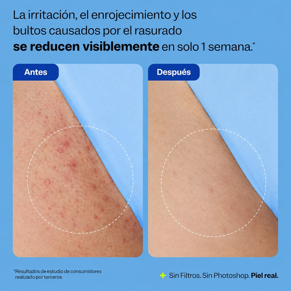 Tratamiento Corporal Exfoliante Antivellos Encarnados
